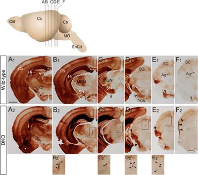 Abnormal Pyramidal Decussation and Bilateral Projection of the Corticospinal Tract Axons in Mice Lacking the Heparan Sulfate Endosulfatases, Sulf1 and Sulf2